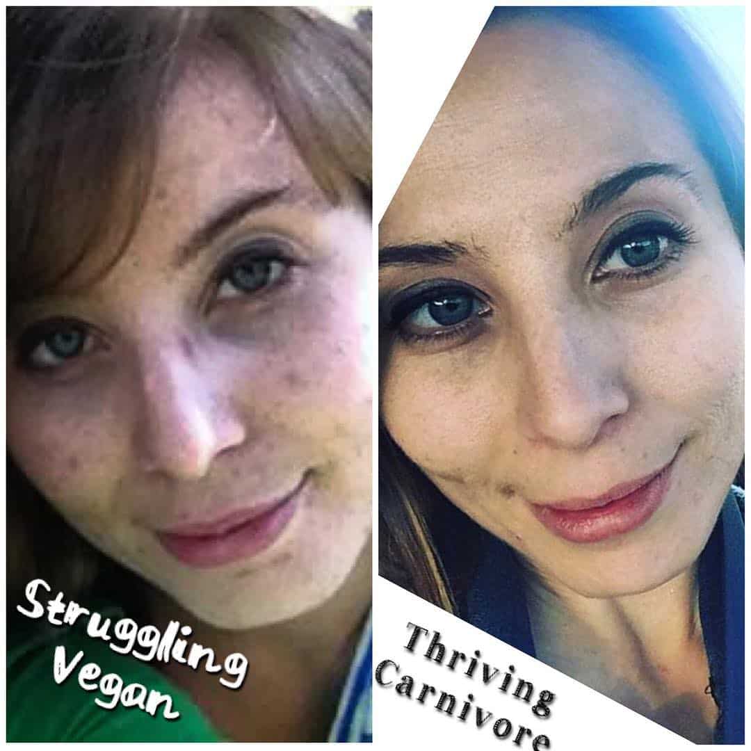 Ashley improves fitness, mood, skin, and weight loss on a carnivore diet