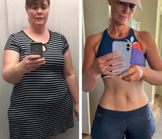 Emily Maintains 150 Lb Weight Loss
